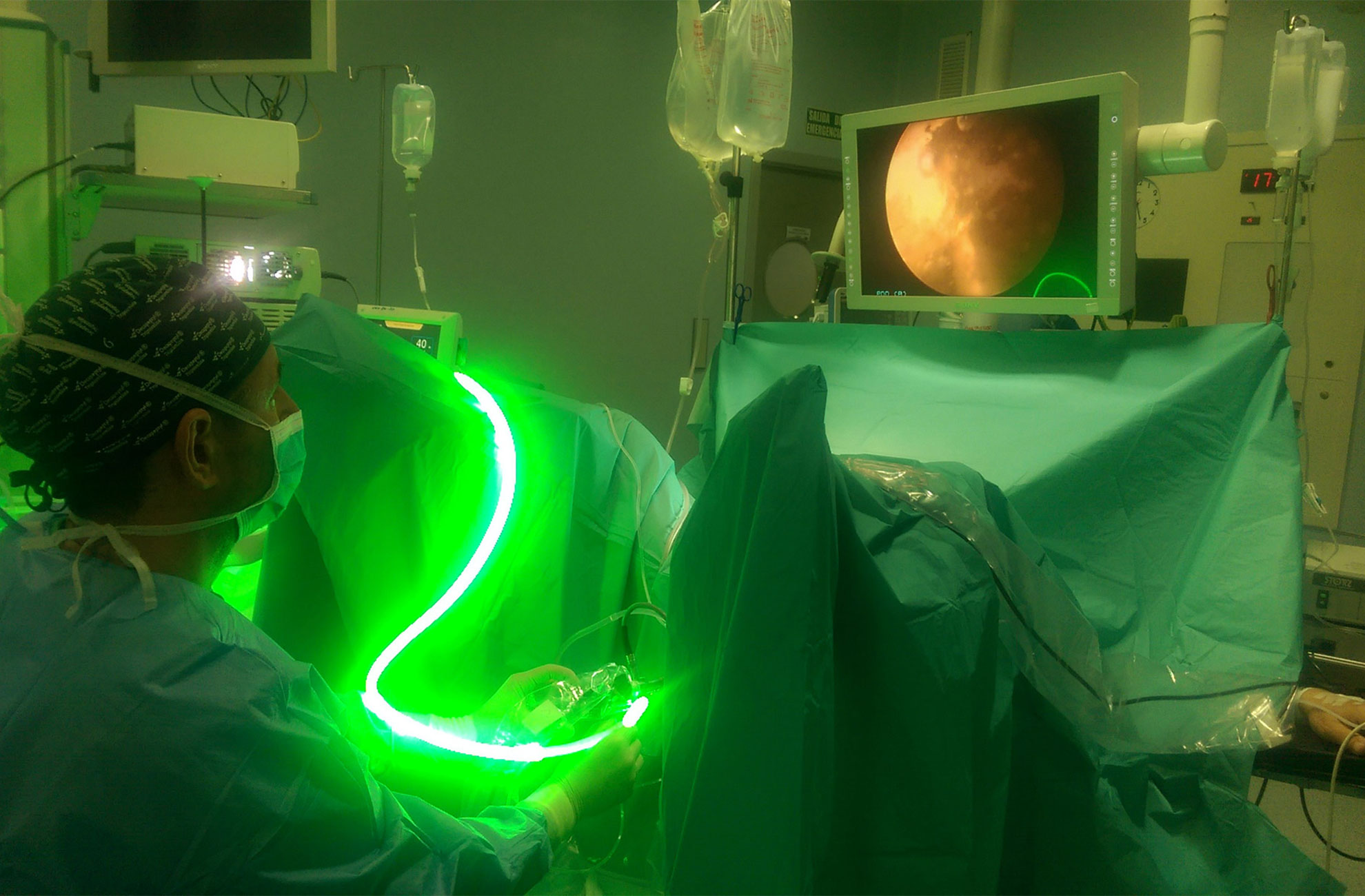 cirugia-urologica-laser