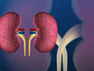 Ilustración anatómica de los riñones y los uréteres.
